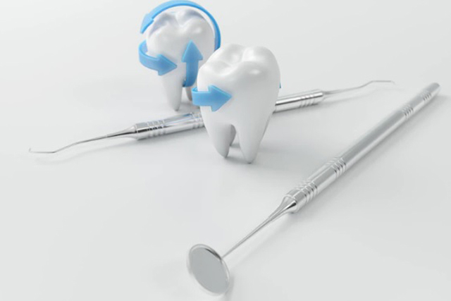 composite-filling