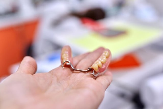 dental-bridge-services