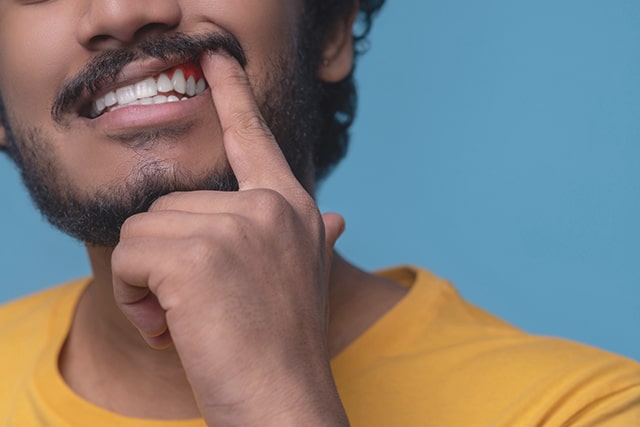 periodontics and treatment